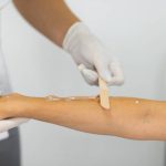 Find a Trusted Skin Tag Removal Clinic